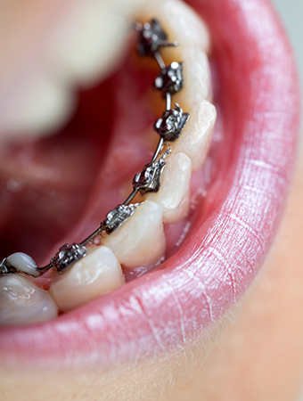 Dentiste Paris Saint Lazare